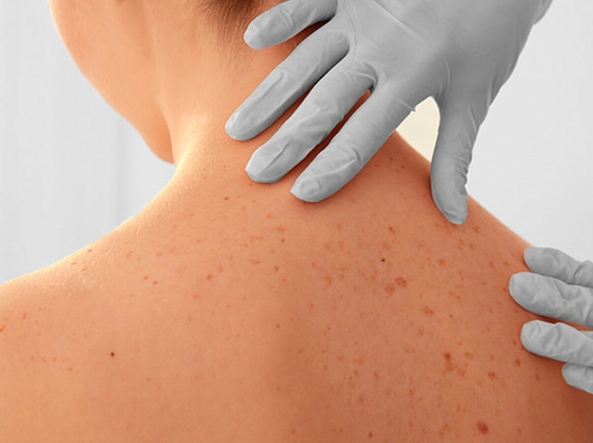 visita nei epiluminescenza pretmedica roma
