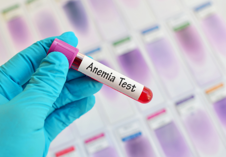 anemia base test