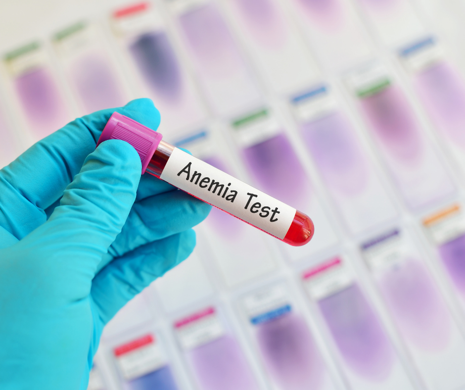 anemia base test